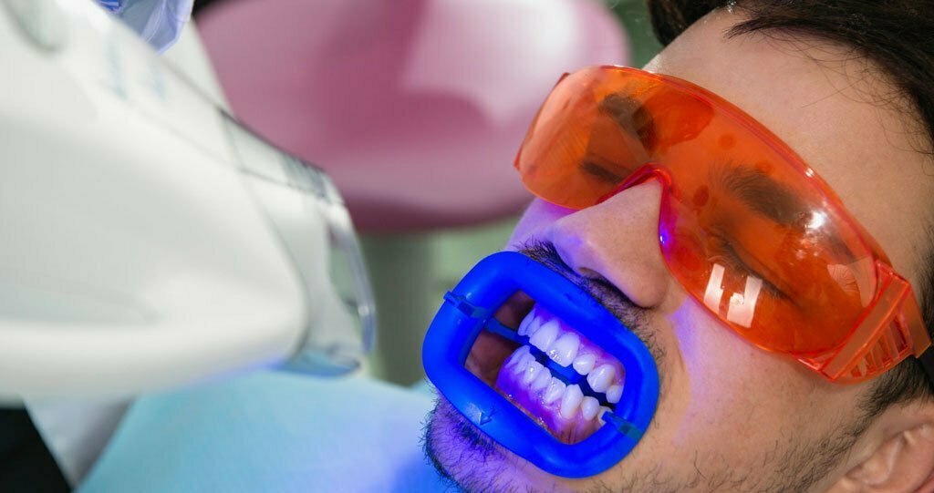 بلیچینگ مطب دندانپزشکی