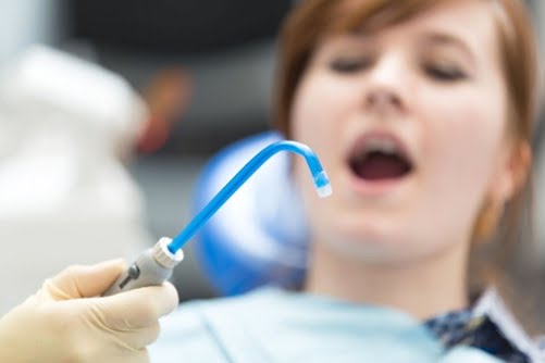 ساکشن دندانپزشکی