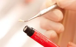 کامپوزیت دندانپزشکی