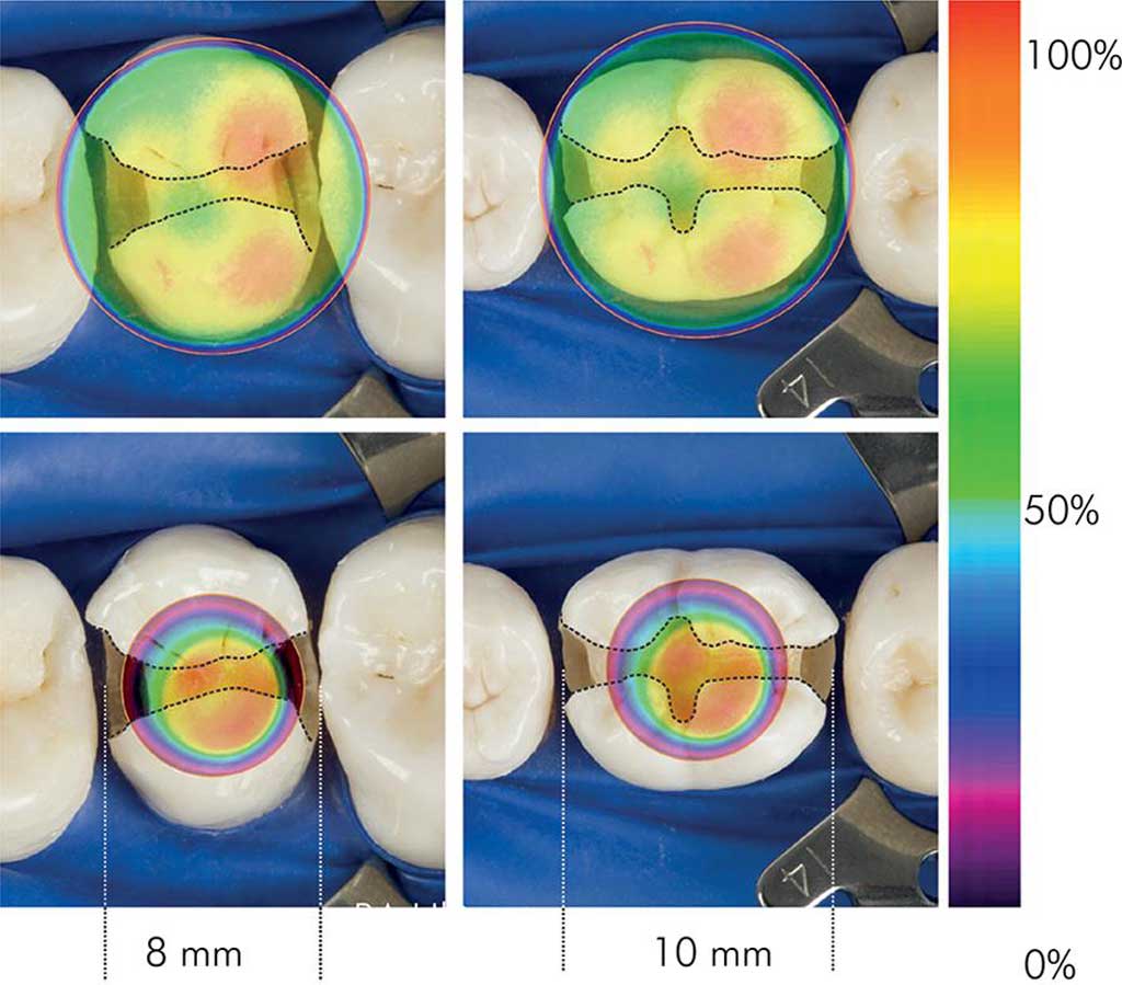 شدت نور در لایت کیور دندانپزشکی
