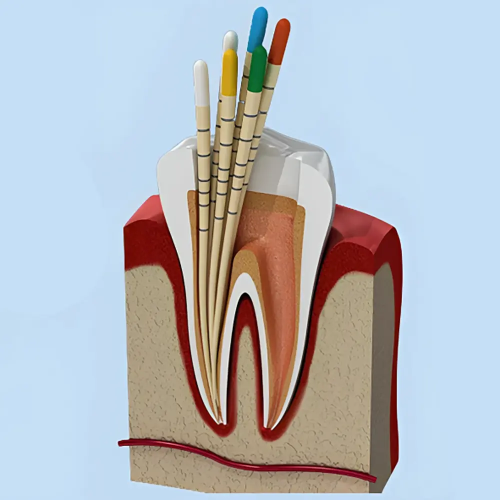 گوتا پرکا | F