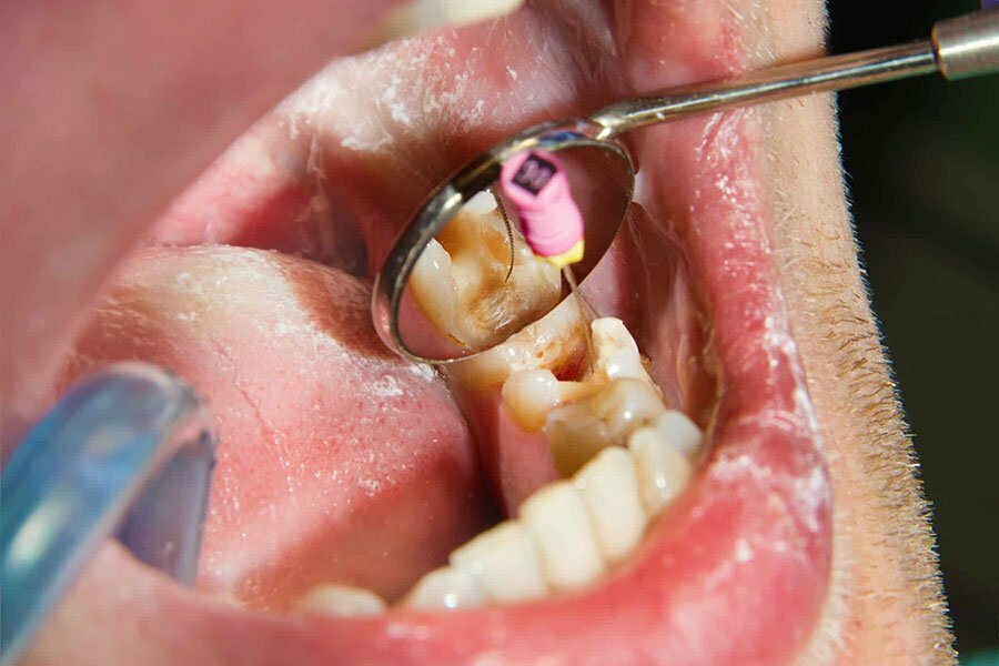 مواد ضدعفونی کننده دندان