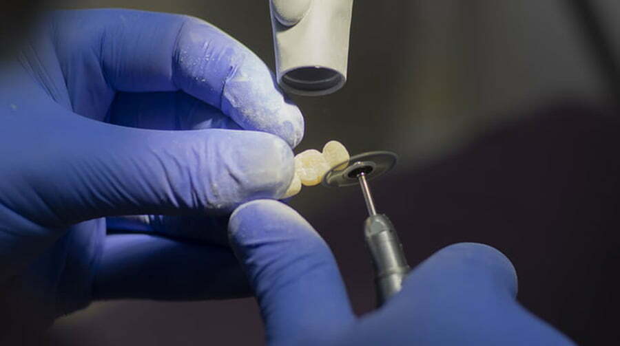 جراحی در دندان پزشکی