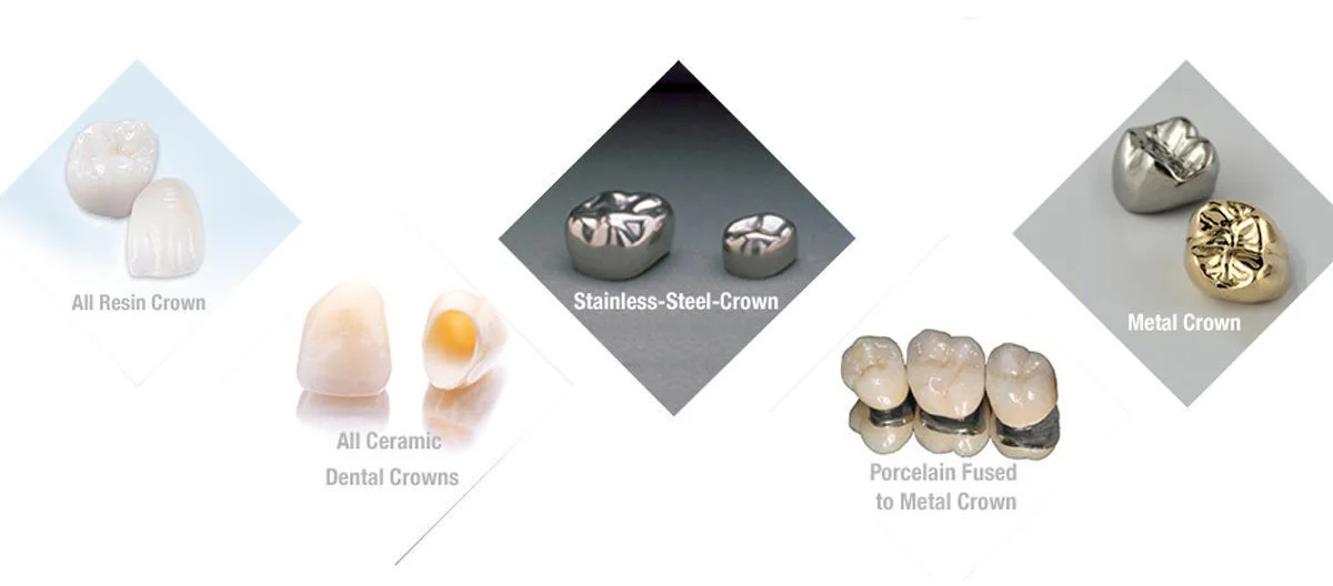 سمان رزینی پالپ دنت | Pulpdent Embrace