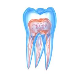 تجهیزات اندو (اندودانتیکس)