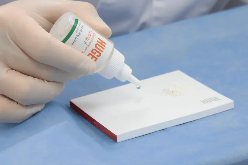 گلاس آینومر لوتینگ هیوج | Cement Luting Huge - Image 2