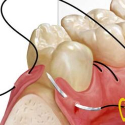 جراحی و پریو