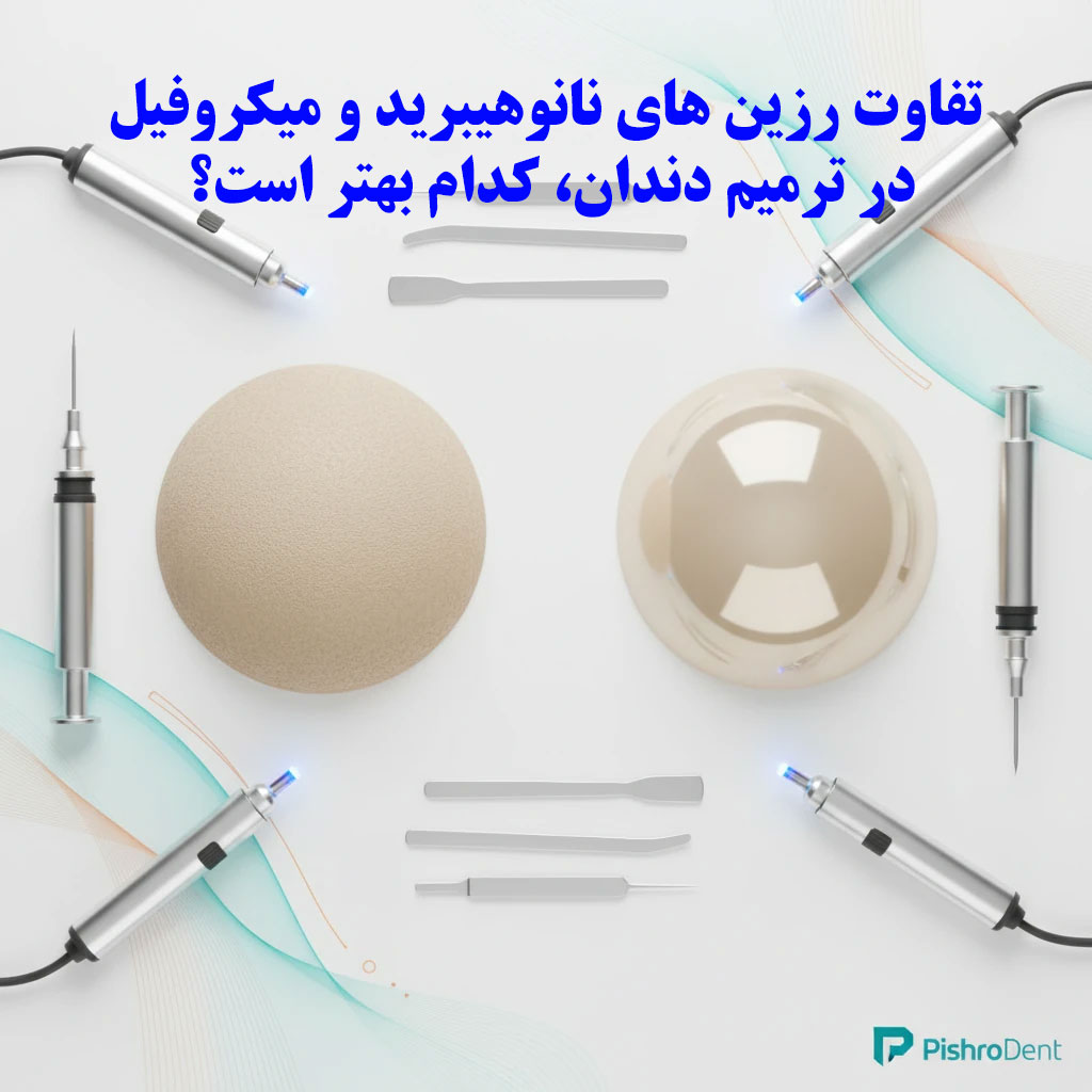 تفاوت رزین های نانوهیبرید و میکروفیل در ترمیم دندان، کدام بهتر است؟